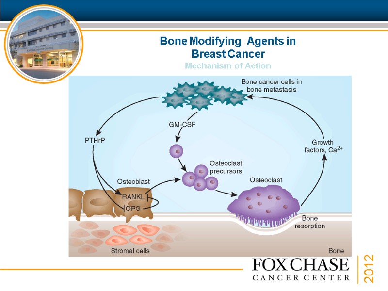 Bone Modifying  Agents in  Breast Cancer Mechanism of Action